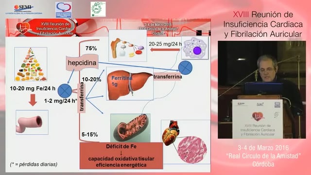 Diagnóstico y tratamiento del déficit de Fe en la IC