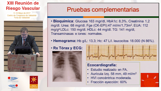 Inicio Mesa Redonda 4: Anticoagulación en el paciente anciano con FANV