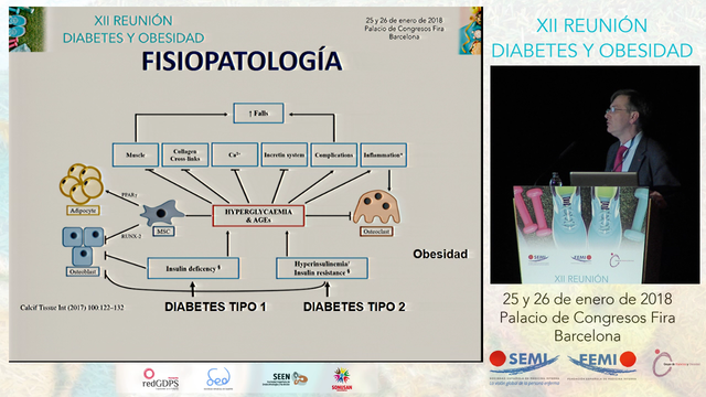 ENCUENTRO CON EL EXPERTO 6: OSTEOPOROSIS