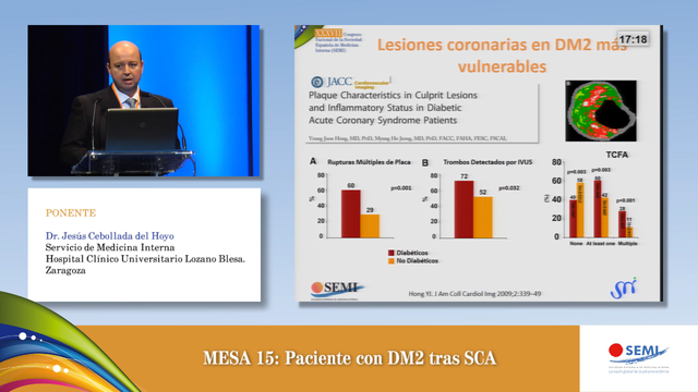 Mesa 15: Nuevas perspectivas en el control metabólico y del riesgo CV en DM2